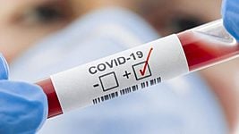 В Беларуси коронавирус официально выявлен у 1981 человека