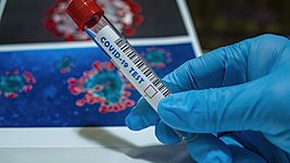 Минздрав подтвердил 49 453 случая заболевания коронавирусом. Умерло 276 человек 