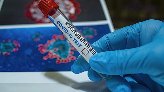 Число выявленных случаев коронавируса в Беларуси превысило 56 тысяч