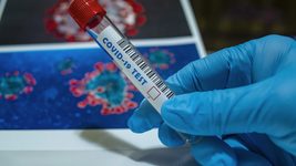 В Беларуси почти 68,4 тысячи официально заболевших коронавирусом 