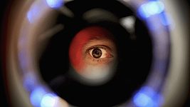 DeepMind научили распознавать заболевания глаз с точностью опытных врачей 