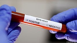 Минздрав подтвердил 951 новый случай коронавируса. Официально заболевших — 28 681