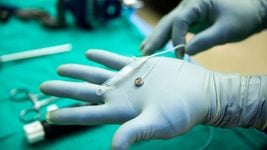 Конкурент Neuralink успешно вживил нейрочип первому пациенту Конкурент Neuralink успешно вживил нейрочип первому пациенту