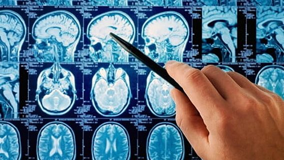87% точности: искусственный интеллект научился читать мысли при помощи сканов мозга 