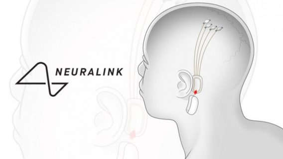 Neuralink ищет компанию для начала испытаний нейрочипа на людях