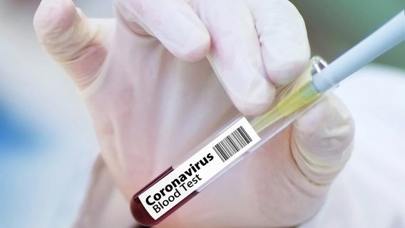 Минздрав подтвердил 56,6 тысячи случаев коронавируса