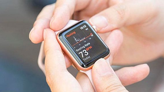 Apple обвинили в краже технологий при создании Apple Watch 