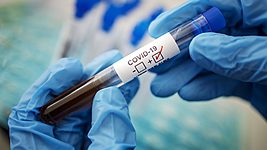 Зарегистрированных случаев коронавируса в Беларуси больше 9,5 тысячи