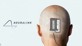 Neuralink впервые вживила чип в мозг человека