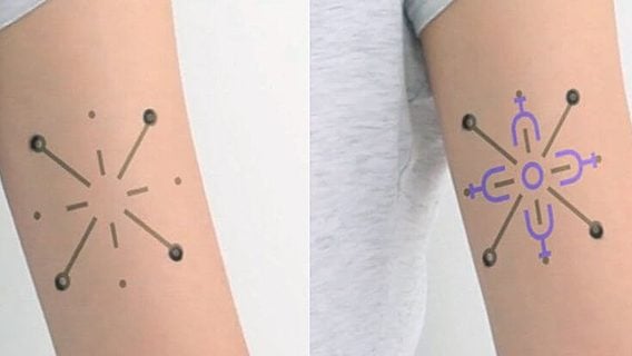 «Умные татуировки» от MIT способны отслеживать изменение здоровья 